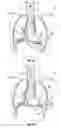 Fig. 04 - Hemodynamic performance enhancement through asymptomatic diaphragm stimulation