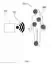 Fig. 02 - Long-range wireless charging enhancement structure for implantable medical devices