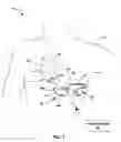 Fig. 02 - Systems and methods for leadless pacing and shock therapy