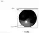 Fig. 02 - Exercise ball