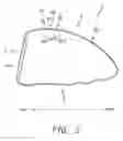 Fig. 04 - Golf club head