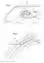 Fig. 02 - Windscreen and device for driving assistance