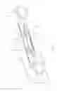 Fig. 07 - SUSPENSION ARM AND MANUFACTURING METHOD THEREFOR