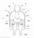 Fig. 01 - Occupant restraint device