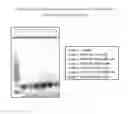 Fig. 02 - NOVEL MODULATORS OF CALCIUM RELEASE-ACTIVATED CALCIUM CHANNEL AND METHODS FOR TREATMENT OF NON-SMALL CELL LUNG CANCER
