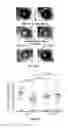 Fig. 02 - Compositions comprising PEDF-derived short peptides and uses thereof