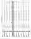 Fig. 2502 - Methods of treating cardiovascular disease with an anti-ASGR antibody or binding fragments thereof
