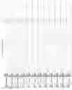 Fig. 2646 - Methods of treating cardiovascular disease with an anti-ASGR antibody or binding fragments thereof