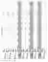 Fig. 2735 - Methods of treating cardiovascular disease with an anti-ASGR antibody or binding fragments thereof