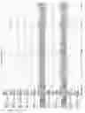 Fig. 2787 - Methods of treating cardiovascular disease with an anti-ASGR antibody or binding fragments thereof