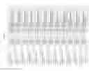 Fig. 2858 - Methods of treating cardiovascular disease with an anti-ASGR antibody or binding fragments thereof