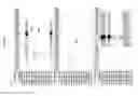 Fig. 2913 - Methods of treating cardiovascular disease with an anti-ASGR antibody or binding fragments thereof