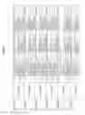 Fig. 389 - Methods of treating cardiovascular disease with an anti-ASGR antibody or binding fragments thereof