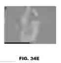 Fig. 57 - MODULATING AUTOIMMUNE DIABETES BY REDUCING OR REMOVING THE RESIDENT MACROPHAGES OF THE ISLETS OF LANGERHANS