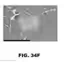 Fig. 58 - MODULATING AUTOIMMUNE DIABETES BY REDUCING OR REMOVING THE RESIDENT MACROPHAGES OF THE ISLETS OF LANGERHANS
