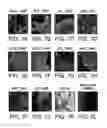Fig. 06 - Methods for neural conversion of human embryonic stem cells
