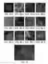 Fig. 09 - Methods for neural conversion of human embryonic stem cells