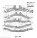 Fig. 45 - Methods for neural conversion of human embryonic stem cells