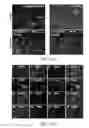Fig. 19 - BIOLOGICALLY RELEVANT IN VITRO SCREENING OF HUMAN NEURONS