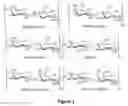 Fig. 02 - Antidote for Chondroitinase