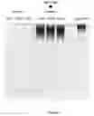 Fig. 06 - Antidote for Chondroitinase