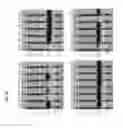 Fig. 22 - Modified bialaphos resistance acetyltransferase compositions and uses thereof