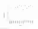 Fig. 06 - Recombinant yeast cell