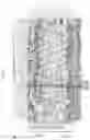 Fig. 04 - Compositions and methods for diagnosing and treating arrhythmias
