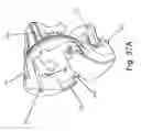 Fig. 35 - Tension rod and pivotable end caps for use therewith