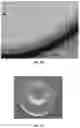 Fig. 07 - Compositions and methods for laser capture microdissection