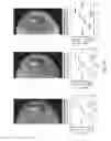 Fig. 35 - Monochromatic x-ray imaging systems and methods