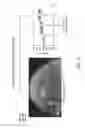 Fig. 71 - Monochromatic x-ray imaging systems and methods