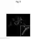 Fig. 07 - Human antibody-producing non-human animal and method for preparing human antibodies using same