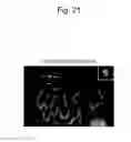 Fig. 22 - Human antibody-producing non-human animal and method for preparing human antibodies using same