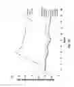 Fig. 17 - Methods of inducing weight loss