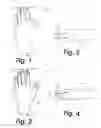 Fig. 02 - TREATMENT APPLICATION GARMENT