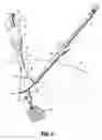 Fig. 05 - Specimen retrieval devices and methods