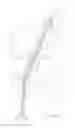Fig. 07 - Method and apparatus for coupling soft tissue to a bone