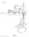 Fig. 02 - Endoscopic surgical systems and methods