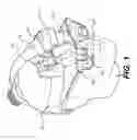 Fig. 02 - Augmented reality navigation systems for use with robotic surgical systems and methods of their use