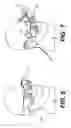 Fig. 07 - Augmented reality navigation systems for use with robotic surgical systems and methods of their use