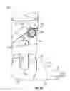 Fig. 03 - Ankle brace