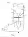 Fig. 04 - Ankle brace