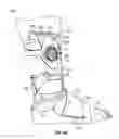 Fig. 06 - Ankle brace