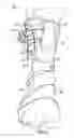 Fig. 08 - Ankle brace