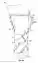 Fig. 09 - Ankle brace