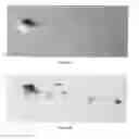 Fig. 06 - METHOD FOR MODIFYING THE REFRACTIVE INDEX OF OCULAR TISSUES