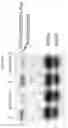Fig. 22 - USES OF HYPOXIA-INDUCIBLE FACTOR INHIBITORS