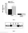 Fig. 02 - Compositions and methods for administration of an enzyme to a subject's airway