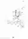 Fig. 02 - Detection of pump thrombosis